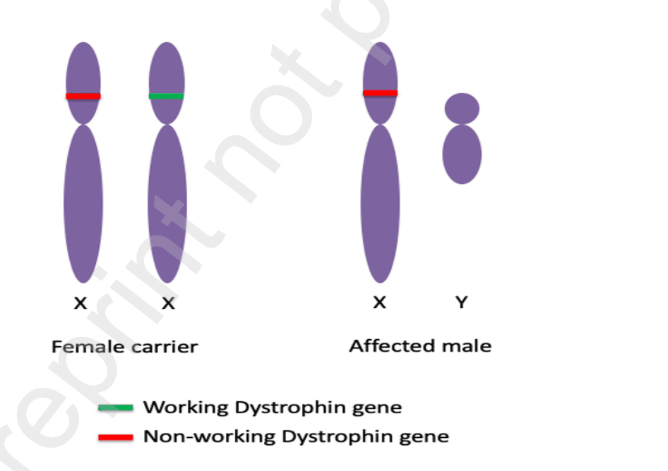 Muscular Dystrophy Image
